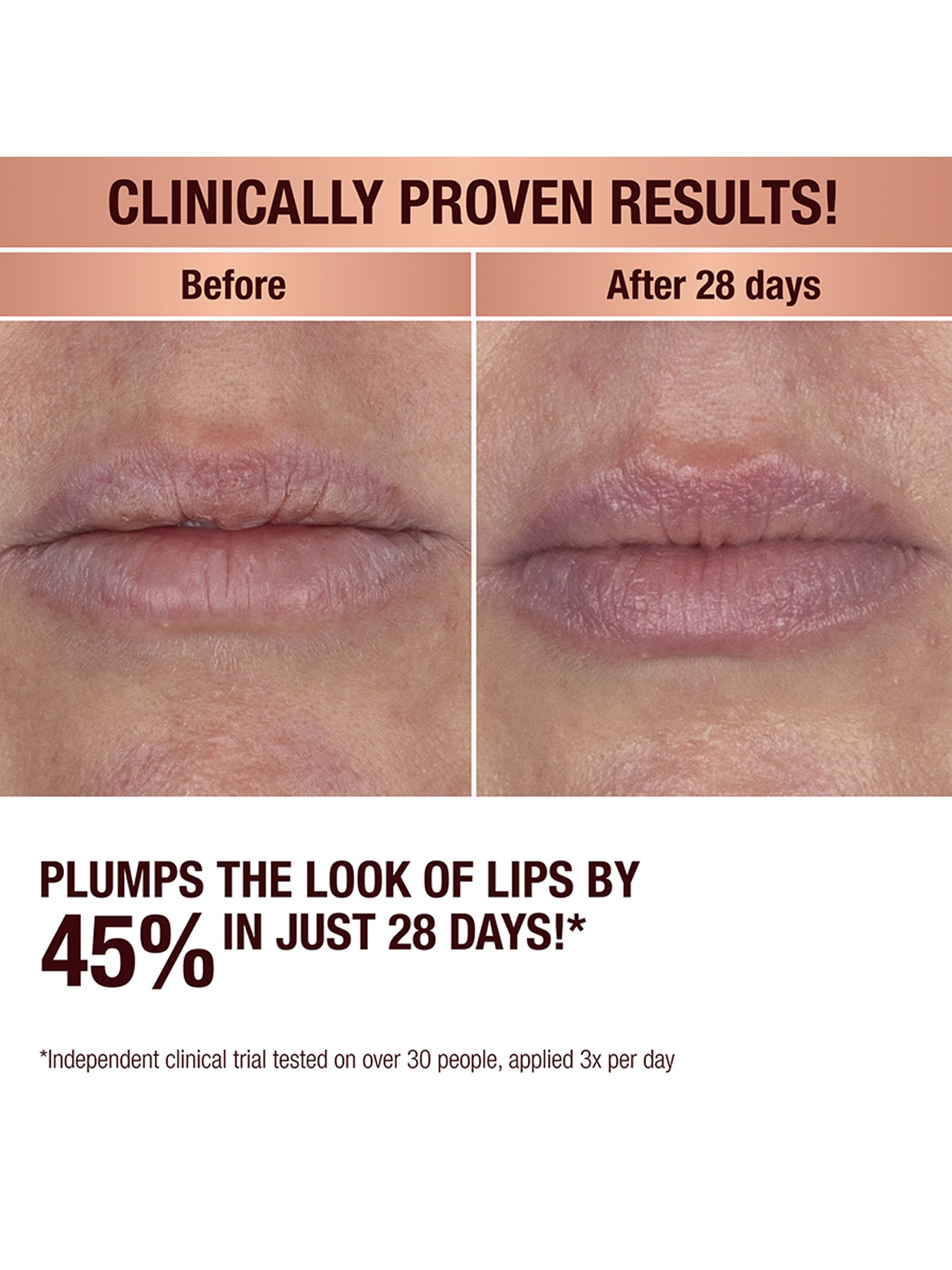 Lip Transformation Elixir