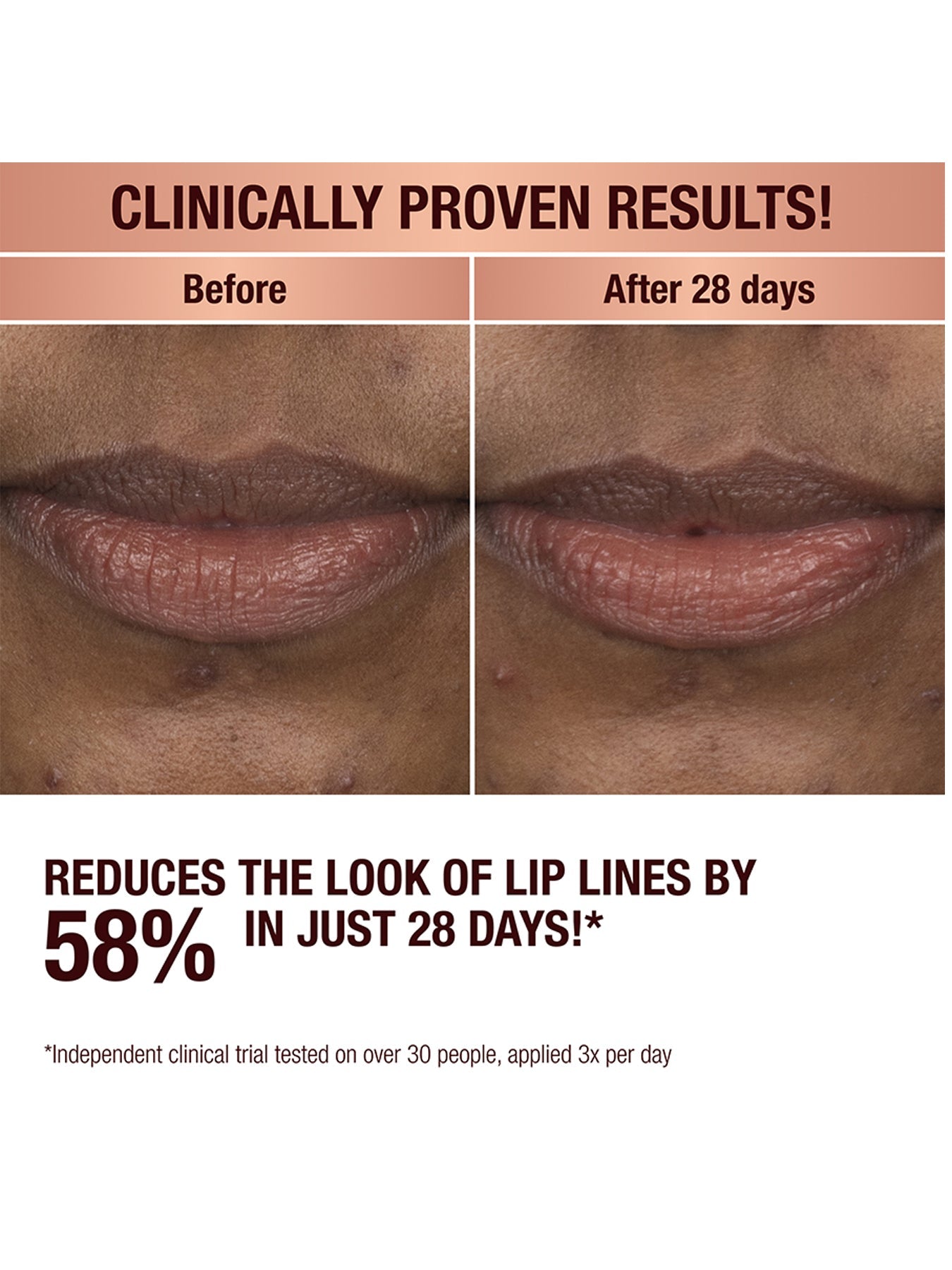 Lip Transformation Elixir