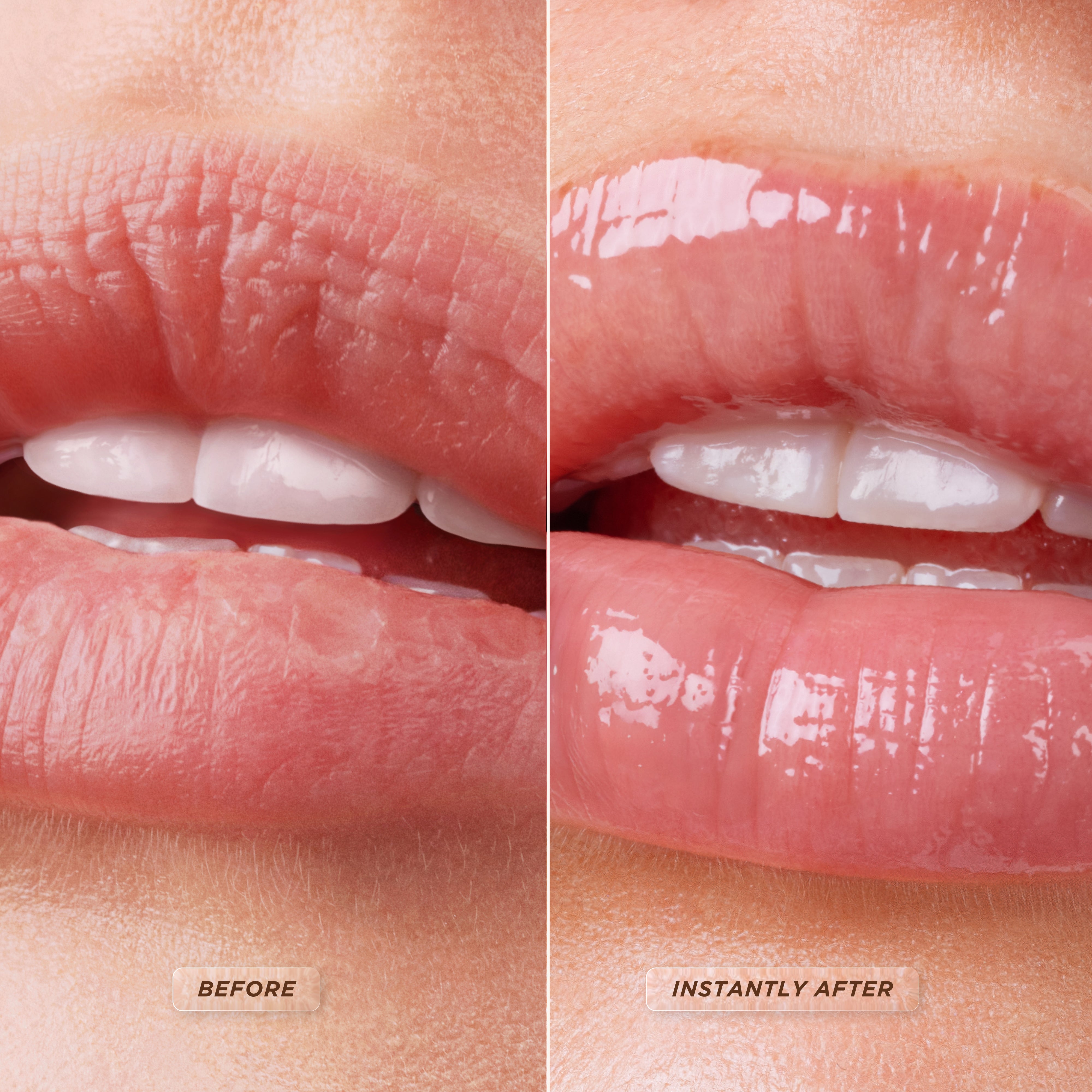 Colágeno Labial com Glacê de Mel