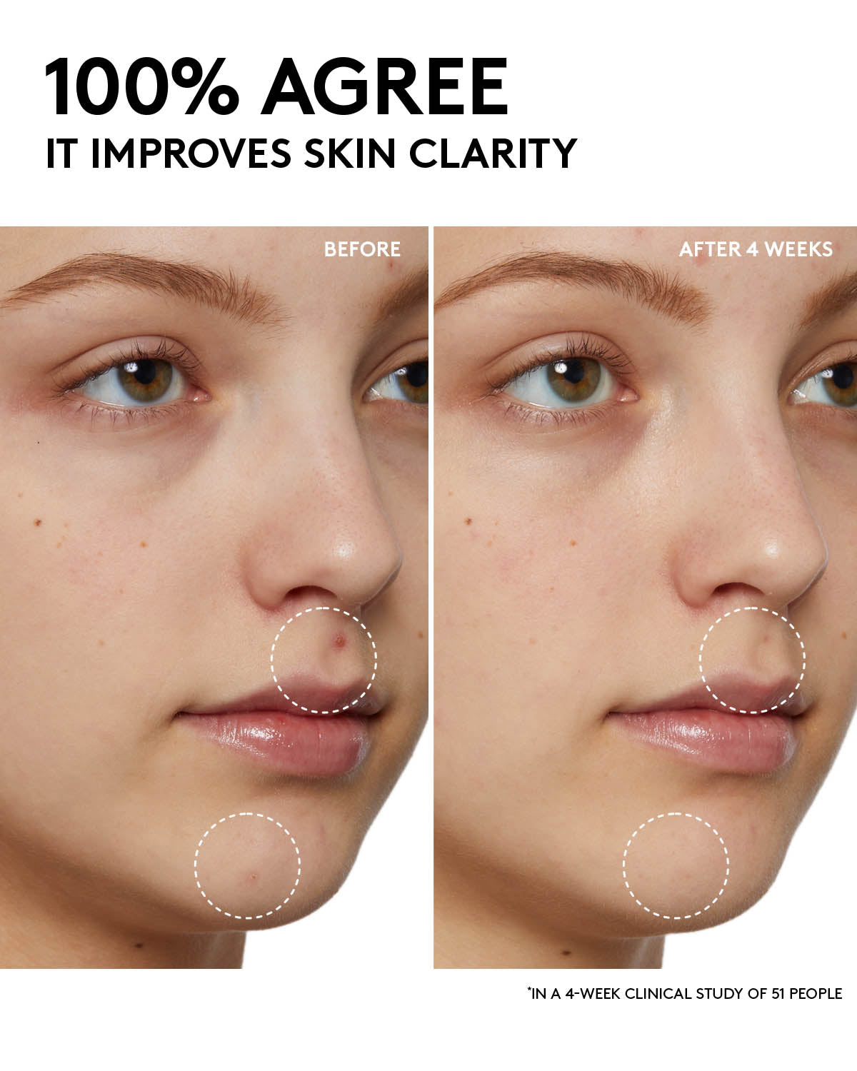 Purifying Cherry Dub Gel Cleanser with Niacinamide & Aloe Essence