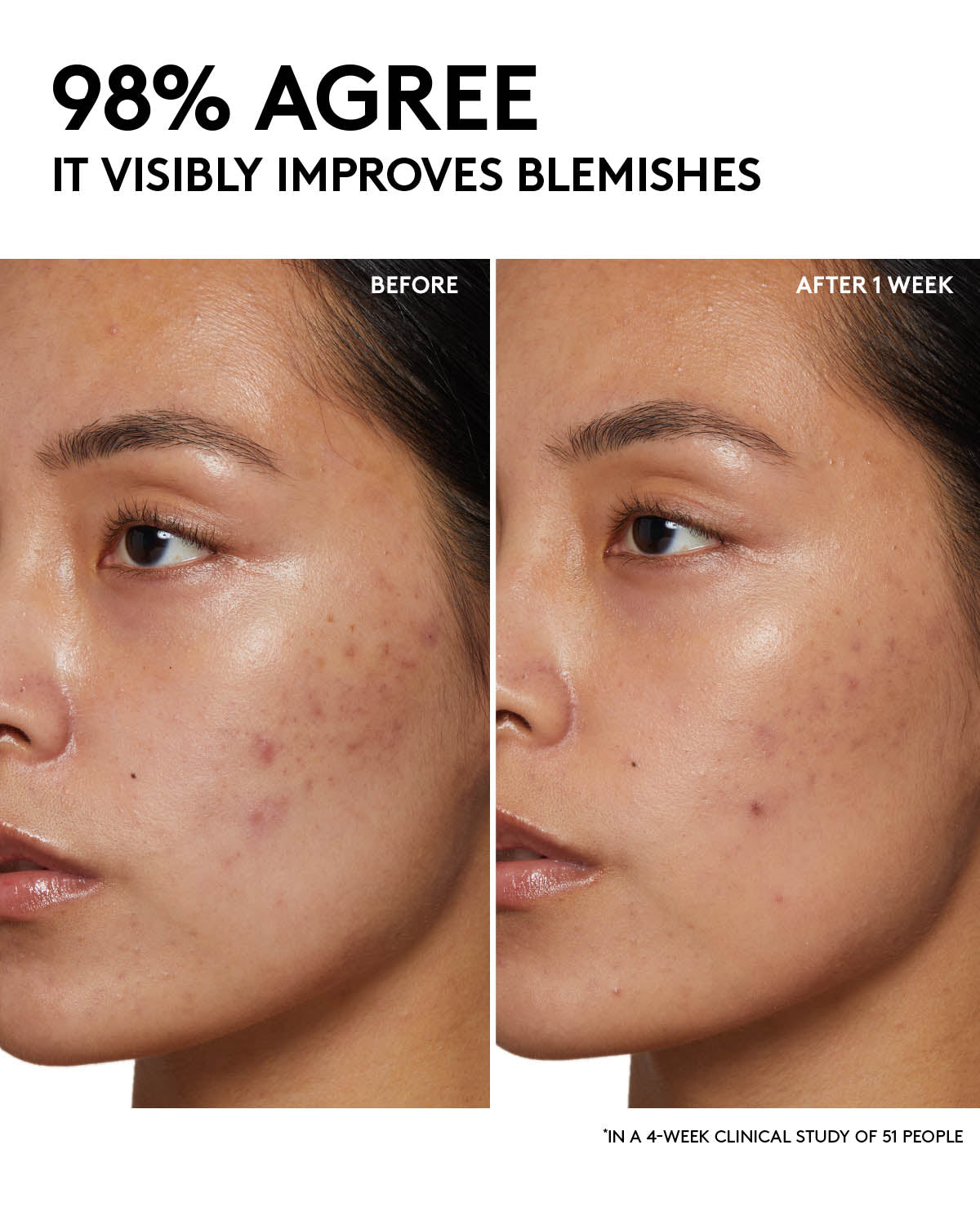 Purifying Cherry Dub Gel Cleanser with Niacinamide & Aloe Essence