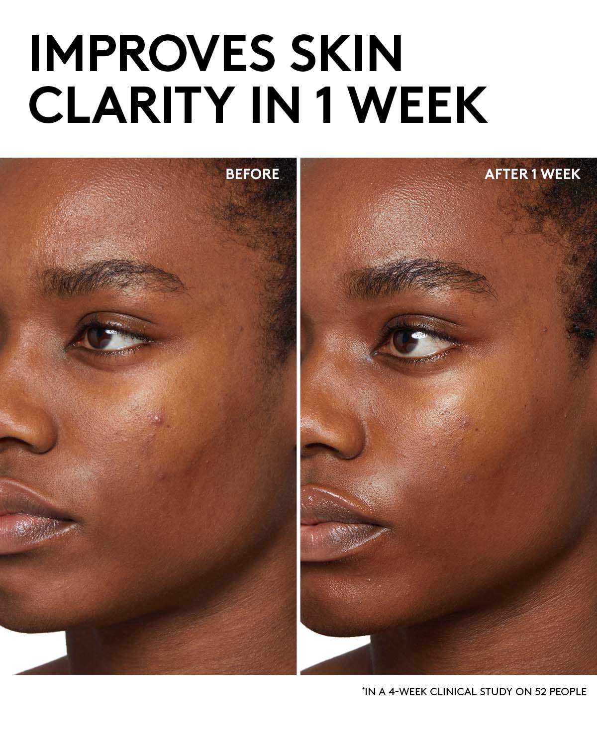Cherry BHA Tonic with Salicylic Acid & Aloe Essence